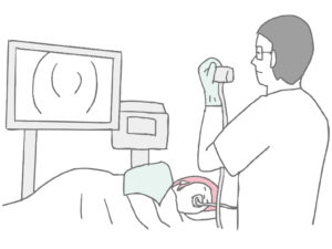 上部消化管内視鏡検査におけるAI活用:現状と未来展望