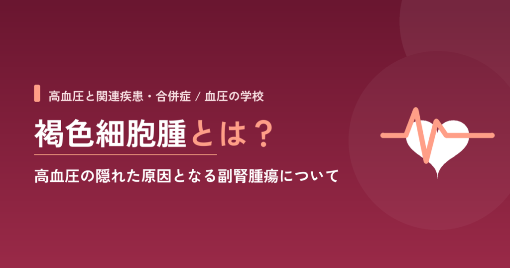 褐色細胞腫とは？高血圧の隠れた原因となる副腎腫瘍について